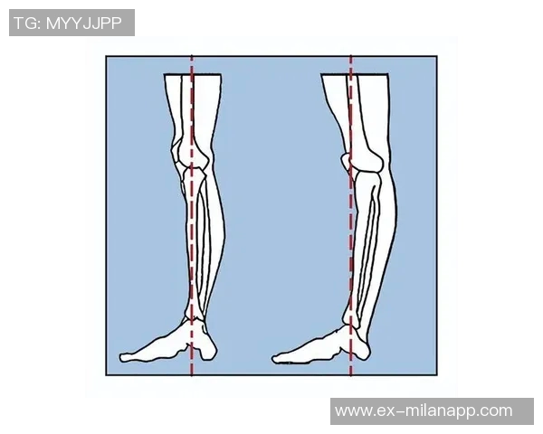 文班左膝疑似过度伸展明日将进行进一步检查以确定伤情